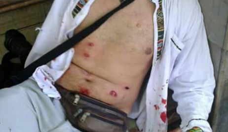 El Sindicato de Prensa repudió la agresión a reporteros gráficos