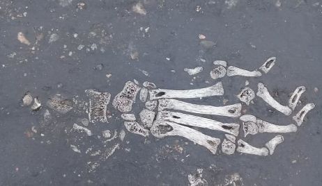¿Son restos óseos?