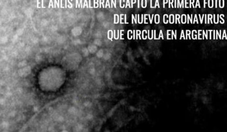El Malbrán consiguió la primera foto del Covid-19 que circula en la Argentina
