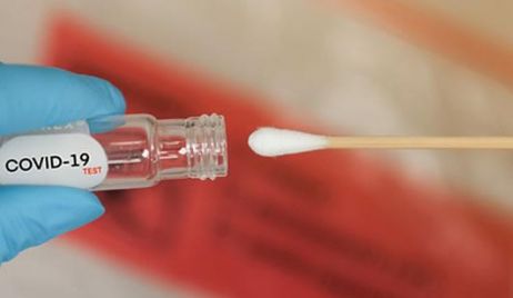 Covid-19: Nuevo protocolo para identificación de caso positivo y aislamiento