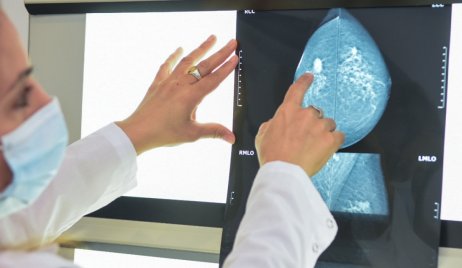 SALUD RECUERDA LAS SEÑALES DE ALERTA Y CONTROLES DE PREVENCIÓN EN EL DÍA MUNDIAL DEL CÁNCER DE MAMA