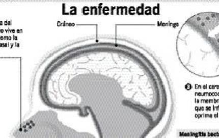 Caso fatal de meningitis bacteriana en Santa Fe