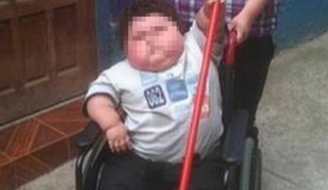 Hablamos con la mamá del nene de 5 años que llegó a 116 Kg