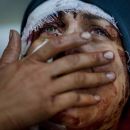 Las fotos que hicieron ganar el Pulitzer a un fotógrafo argentino