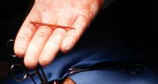 Inédito: le extrajeron un escarbadientes del corazón